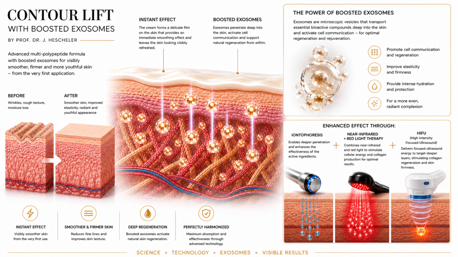 CONTOUR LIFT™